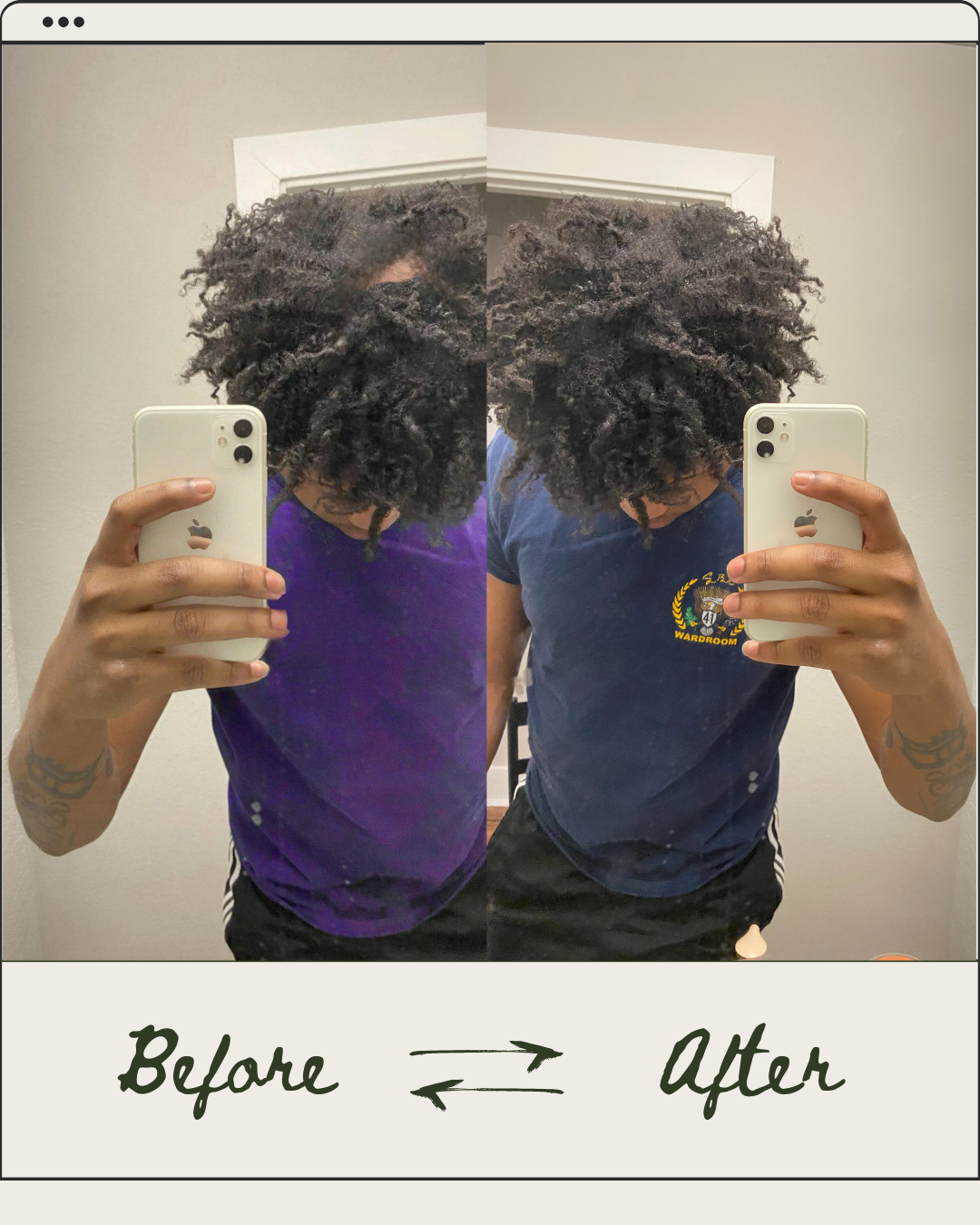 Reclaim Your Hairline. Reclaim Your Confidence